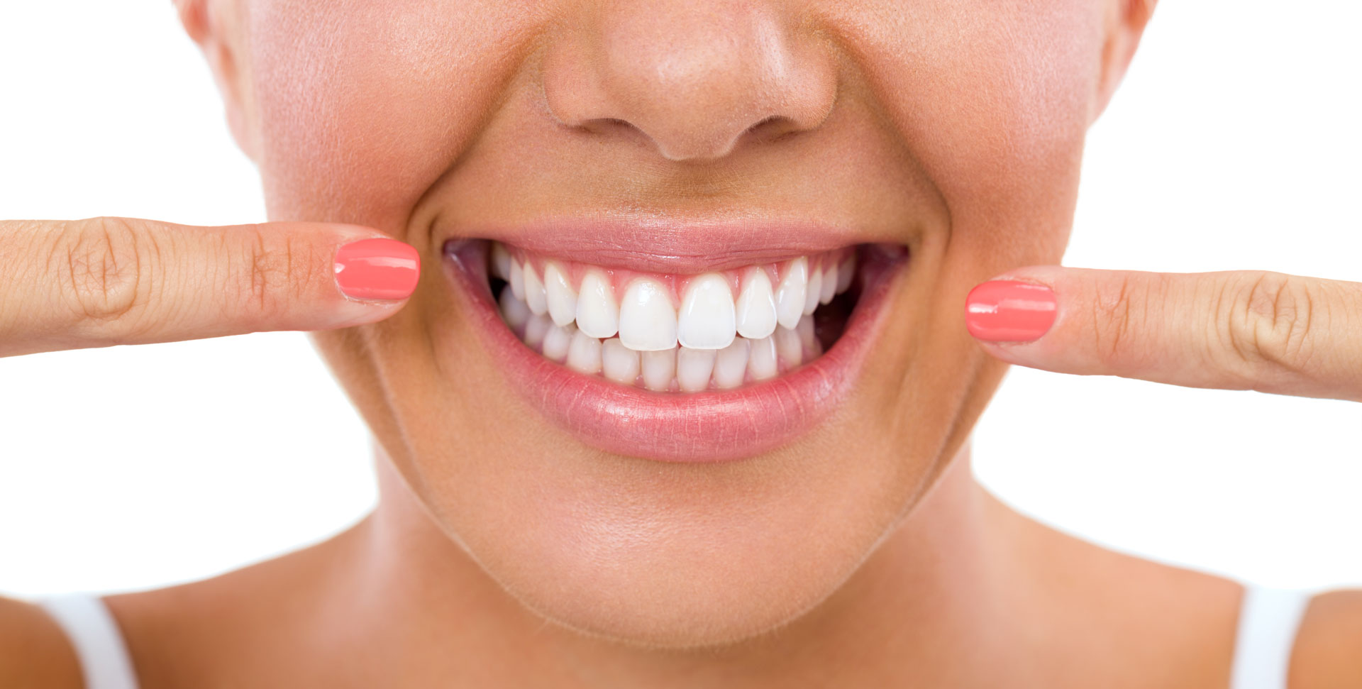 Ortodonzia: allineare la dentatura per un sorriso al Top