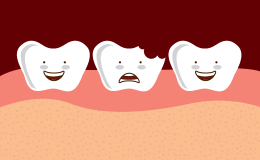 Dente rotto: come risolvere in poco tempo